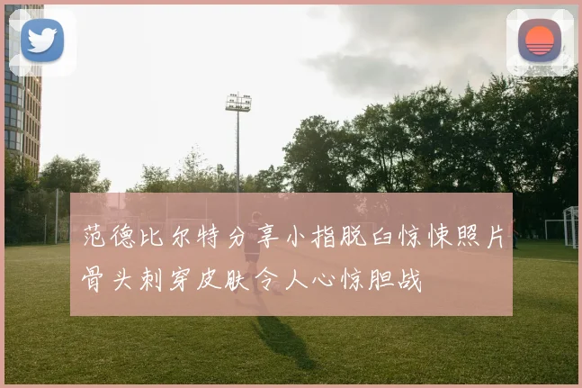范德比尔特分享小指脱臼惊悚照片骨头刺穿皮肤令人心惊胆战